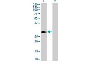 Western Blot analysis of FHL1 expression in transfected 293T cell line by FHL1 MaxPab polyclonal antibody. (FHL1 Antikörper  (AA 1-280))