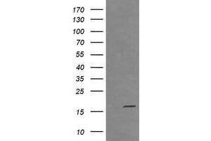 Image no. 1 for anti-Cancer/testis Antigen 1B (CTAG1B) antibody (ABIN1499889) (CTAG1B Antikörper)