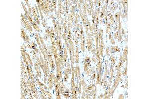IHC analysis of SPAG7 using anti-SPAG7 antibody (ABIN7599072). (SPAG7 Antikörper  (AA 1-199))