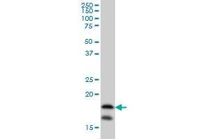 NME2 monoclonal antibody (M08), clone 1F2 Western Blot analysis of NME2 expression in HeLa . (NME2 Antikörper  (AA 51-152))