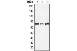 Western blot analysis of LIMK2 expression in Jurkat (A), COLO205 (B), MCF7 (C) whole cell lysates.