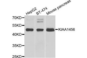 Western blot analysis of extracts of various cell lines, using KIAA1456 antibody.