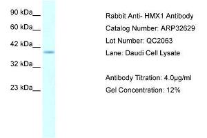 WB Suggested Anti-HMX1 AntibodyTitration: 4. (HMX1 Antikörper  (Middle Region))