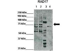 WB Suggested Anti-RAD17 Antibody  Positive Control: Lane1: 25ug Hela lysate, Lane2: 25ug HEK293T lysate, Lane3: 25ug Xenopus laevis egg extract, Lane4: 25ug mouse embryonic stem cells lysate Primary Antibody Dilution :  1:500 Secondary Antibody :  Anti-rabbit-HRP  Secondry Antibody Dilution :  1:3000 Submitted by: Domenico Maiorano, Institute of Human Genetics, CNRS (RAD17 Antikörper  (C-Term))