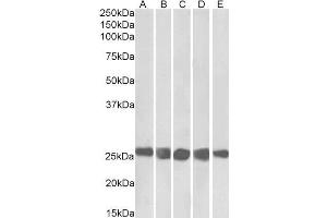 ABIN5539634 (0. (CSNK2B Antikörper  (AA 172-186))