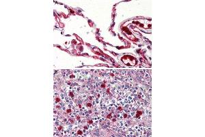 Immunohistochemistry (Formalin/PFA-fixed paraffin-embedded sections) of human lung (A) and human spleen, red pulp (B) tissue with GPR132 polyclonal antibody . (G Protein-Coupled Receptor 132 Antikörper  (Cytoplasmic Domain))