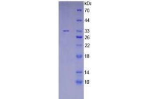 SDS-PAGE (SDS) image for Meningioma Expressed Antigen 5 (Hyaluronidase) (MGEA5) ELISA Kit (ABIN6574133)