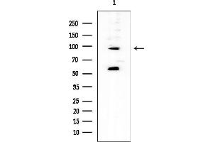 Western blot analysis of lysates from EC304 cells, using TAS1R2 Mouse Monoclonal Antibody at 1/1000 dilution.