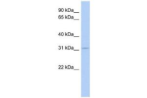 AES antibody used at 0. (AES Antikörper  (Middle Region))