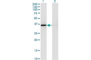 Western Blot analysis of MDH1 expression in transfected 293T cell line by MDH1 monoclonal antibody (M03), clone 1D2. (MDH1 Antikörper  (AA 101-193))