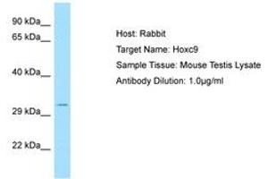 Image no. 1 for anti-Homeobox C9 (HOXC9) (C-Term) antibody (ABIN6749849) (HOXC9 Antikörper  (C-Term))