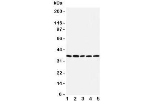 Western blot testing of IRF1 antibody and Lane 1:  COLO320;  2: U87;  3: HeLa;  4: Jurkat;  5: MCF-7 cell lysate (IRF1 Antikörper  (Middle Region))