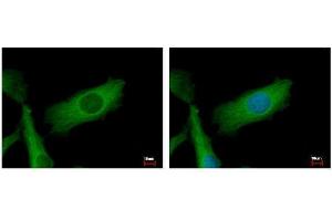 ICC/IF Image NDUFS2 antibody detects NDUFS2 protein at mitochondria by immunofluorescent analysis.