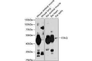 Western blot analysis of extracts of various cell lines, using COLQ antibody (ABIN6131427, ABIN6138859, ABIN6138860 and ABIN6214704) at 1:1000 dilution. (COLQ Antikörper  (AA 276-455))