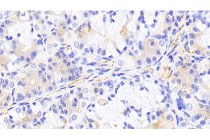 Detection of PIK3Cb in Human Stomach Tissue using Polyclonal Antibody to Phosphoinositide-3-Kinase Catalytic Beta Polypeptide (PIK3Cb) (PIK3CB Antikörper  (AA 524-703))