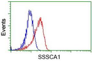 Image no. 2 for anti-Sjogren Syndrome/scleroderma Autoantigen 1 (SSSCA1) antibody (ABIN1501155)