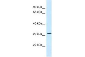 Image no. 1 for anti-Chromosome 18 Open Reading Frame 1 (C18orf1) (AA 176-225) antibody (ABIN6747751) (C18orf1 Antikörper  (AA 176-225))