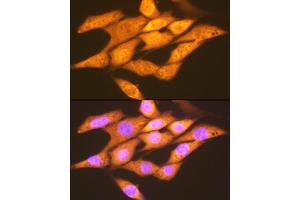 Immunofluorescence analysis of NIH-3T3 cells using FGF1 Rabbit mAb (ABIN7267182) at dilution of 1:100 (40x lens). (FGF1 Antikörper)