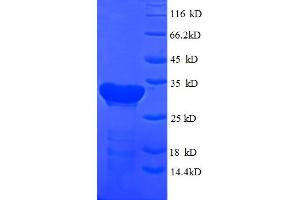 SDS-PAGE (SDS) image for Cytochrome C Oxidase Subunit IV Isoform 1 (COX4I1) (AA 23-169) protein (His-SUMO Tag) (ABIN5709313)