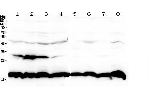 Western blot analysis of Cyclophilin B using anti-Cyclophilin B antibody . (PPIB Antikörper  (AA 158-216))