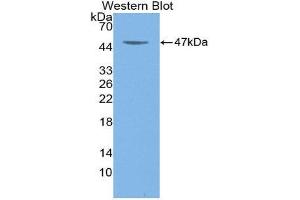 Western Blotting (WB) image for anti-Colony Stimulating Factor 2 (Granulocyte-Macrophage) (CSF2) (AA 18-144) antibody (ABIN1868194)
