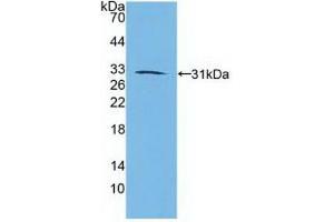 Western blot analysis of recombinant Human RARb. (Retinoic Acid Receptor beta Antikörper  (AA 205-451))