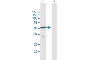 Western Blot analysis of SHPK expression in transfected 293T cell line by SHPK MaxPab polyclonal antibody. (SHPK Antikörper  (AA 1-478))