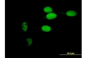 Immunofluorescence of purified MaxPab antibody to TIMELESS on HeLa cell. (TIMELESS Antikörper  (AA 1-1208))