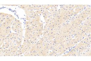 Detection of PARP4 in Human Cardiac Muscle Tissue using Polyclonal Antibody to Poly ADP Ribose Polymerase 4 (PARP4) (PARP4 Antikörper  (AA 338-609))