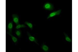 Detection of FADS2 in Human HepG2 cell using Polyclonal Antibody to Fatty Acid Desaturase 2 (FADS2) (FADS2 Antikörper  (AA 1-130))