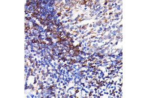 Immunohistochemistry of paraffin-embedded human appendix using SHP1 Rabbit mAb (ABIN7269716) at dilution of 1:100 (40x lens). (SHP1 Antikörper)