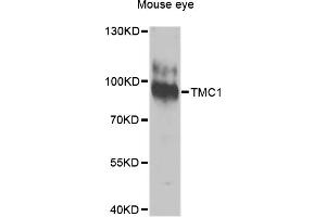 Western blot analysis of extracts of mouse eye, using TMC1 antibody. (TMC1 Antikörper)