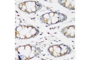 Immunohistochemistry of paraffin-embedded human colon using BMP2 antibody. (BMP2 Antikörper  (AA 283-396))