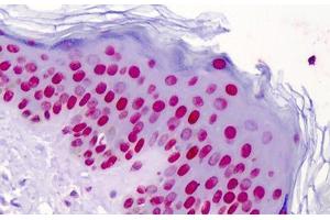 Human Skin: Formalin-Fixed, Paraffin-Embedded (FFPE)