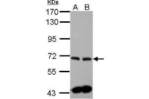 WB Image Sample (30 ug of whole cell lysate) A: PC-3 B: U87-MG 7. (SPHK2 Antikörper)