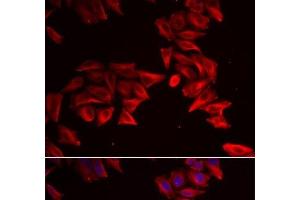 Immunofluorescence analysis of HeLa cells using SFRP4 Polyclonal Antibody (SFRP4 Antikörper)