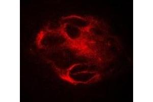 Immunofluorescent analysis of RBAT staining in Hela cells. (SLC3A1 Antikörper)