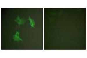 Immunofluorescence analysis of NIH/3T3 cells, using Tubulin α antibody. (TUBA1A Antikörper  (C-Term))