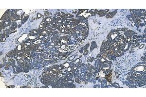 IHC analysis of GABARAP using anti-GABARAP antibody (ABIN7603159). (GABARAP Antikörper  (N-Term))