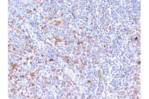 Formalin-fixed, paraffin-embedded human Tonsil stained with RCAS1 Mouse Monoclonal Antibody (CPTC-EBAG9-2). (RCAS1 Antikörper)