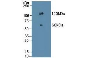 Detection of CDH17 in Mouse Colon Tissue using Polyclonal Antibody to Cadherin 17 (CDH17) (LI Cadherin Antikörper  (AA 67-351))