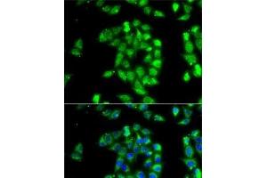 Immunofluorescence analysis of MCF7 cells using ANTXR1 Polyclonal Antibody (ANTXR1 Antikörper)
