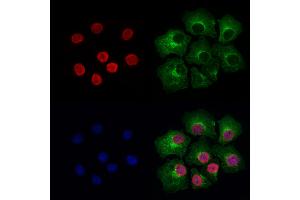 ABIN6264887 and ABIN6276947 staining Hela cells by IF/ICC. (RUVBL2 Antikörper  (Internal Region))