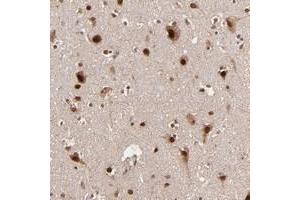 Immunohistochemical staining of human cerebral cortex with TOP1MT polyclonal antibody  shows strong nuclear and cytoplasmic positivity in neuronal cells. (TOP1MT Antikörper)