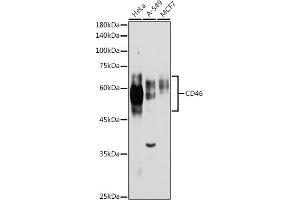 Western Blotting (WB) image for anti-CD46 (CD46) (AA 40-320) antibody (ABIN1512715)