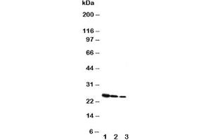 Western blot testing of Growth Hormone antibody and Lane 1:  Recombinant rat GH protein 10ng;  2: 5ng;  3: 2. (Growth Hormone 1 Antikörper  (AA 27-216))