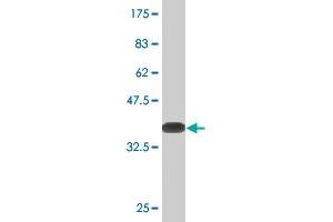 Western Blot detection against Immunogen (36. (PKC delta Antikörper  (AA 577-676))