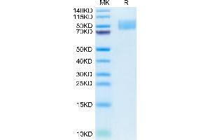 ICAM1 Protein (AA 28-480) (His tag)