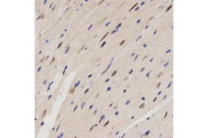 Immunohistochemistry (IHC) image for anti-Family with Sequence Similarity 160, Member B2 (FAM160B2) antibody (ABIN1872648) (FAM160B2 Antikörper)