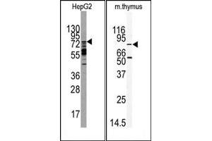Image no. 1 for anti-MAP/microtubule Affinity-Regulating Kinase 2 (MARK2) (C-Term) antibody (ABIN360425) (MARK2 Antikörper  (C-Term))